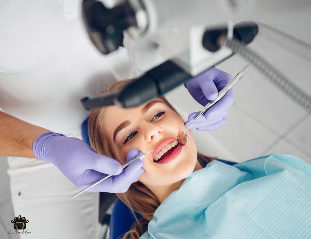 Why Are Dental Fillings Necessary Elite Dental Care Tracy